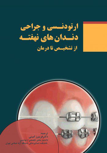 ارتودنسی و جراحی دندان های نهفته از تشخیص تا درمان