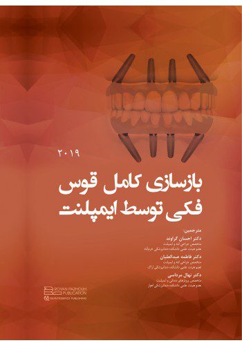 بازسازی کامل قوس فکی توسط ایمپلنت 2019