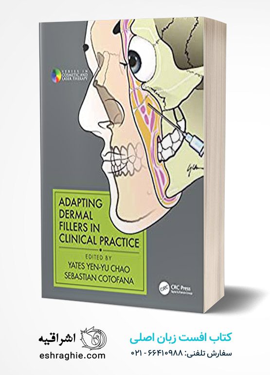 Adapting Dermal Fillers in Clinical Practice