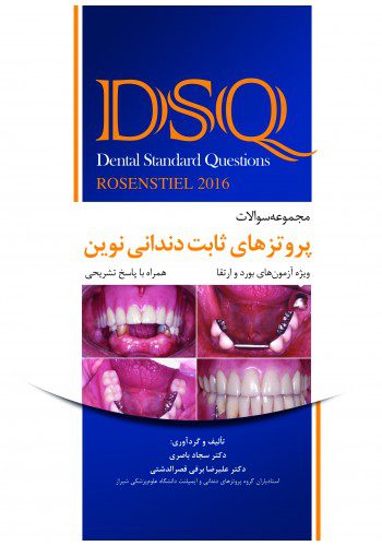 DSQ مجموعه سوالات پروتزهای ثابت دندانی نوین رزنستیل 2016