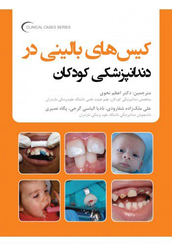 کیس های بالینی در دندانپزشکی کودکان