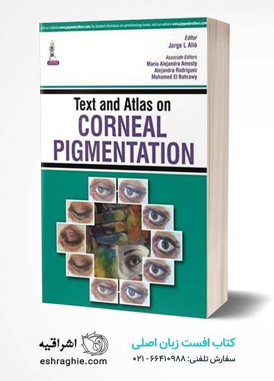 Text and Atlas on Corneal Pigmentation