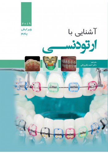 آشنایی با ارتودنسی