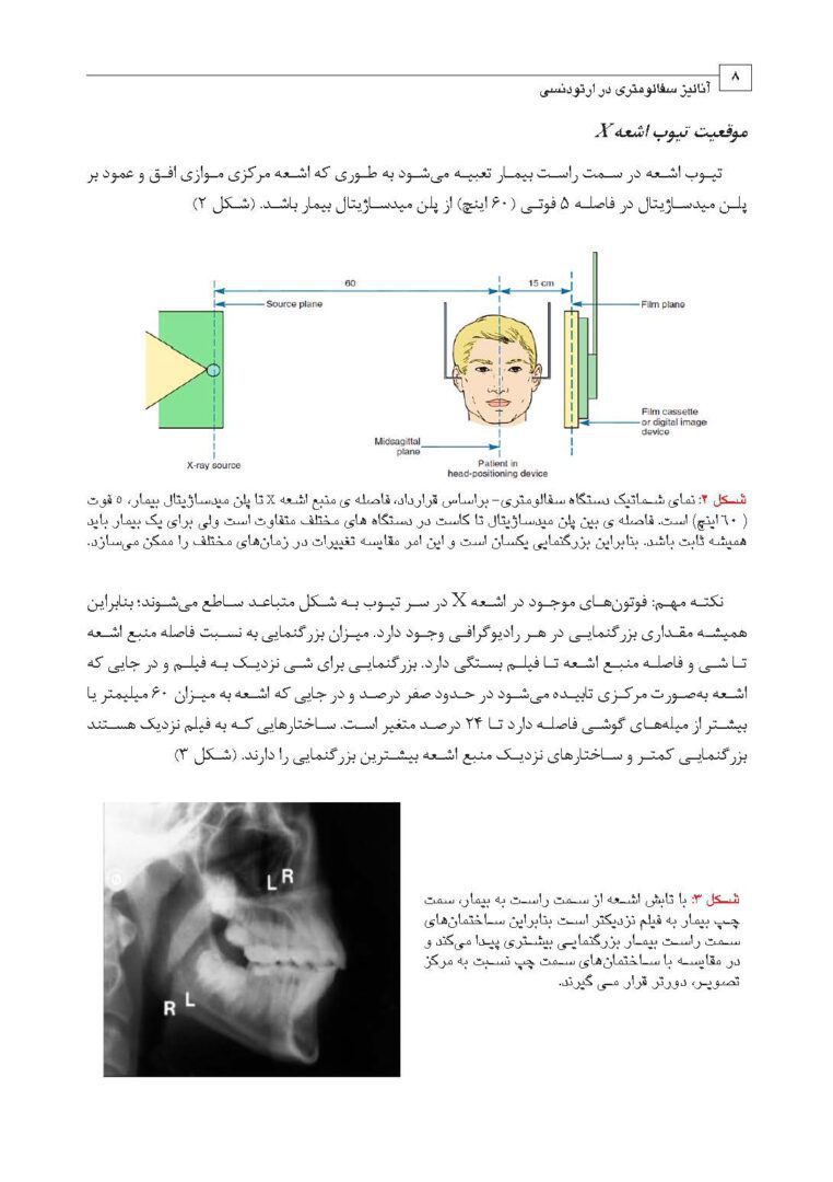 آنالیز سفالومتری در ارتودنسی 7