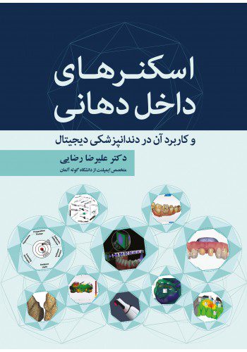 اسکنرهای داخل دهانی و کاربرد آن در دندانپزشکی دیجیتال