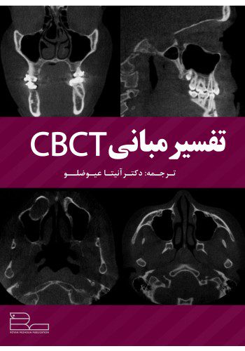 تفسیر مبانی CBCT
