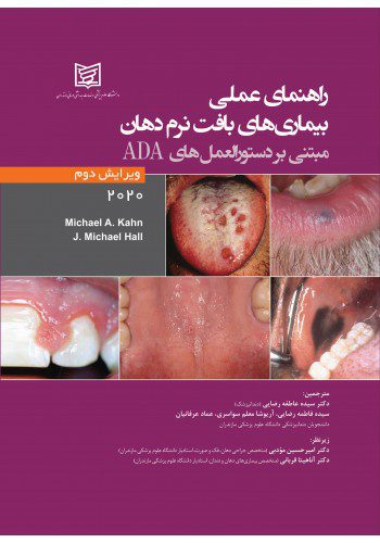 راهنمای عملی بیماری های بافت نرم دهان مبتنی بر دستورالعمل های ADA