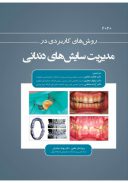 روش های کاربردی در مدیریت سایش های دندانی ۲۰۲۰
