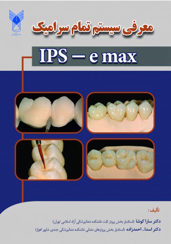 معرفی سیستم تمام سرامیک IPS - e max