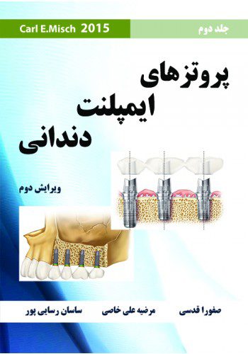 پروتزهای ایمپلنت دندانی میش 2015 (Misch 2015) - جلد دوم