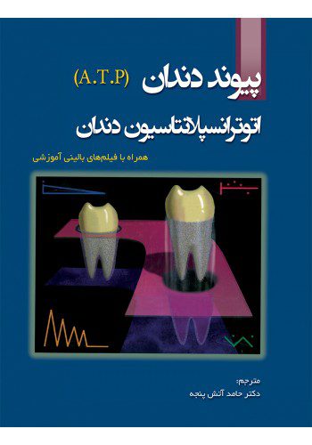پیوند دندان: اتوترانسپلانتاسیون دندان (A.T.P)