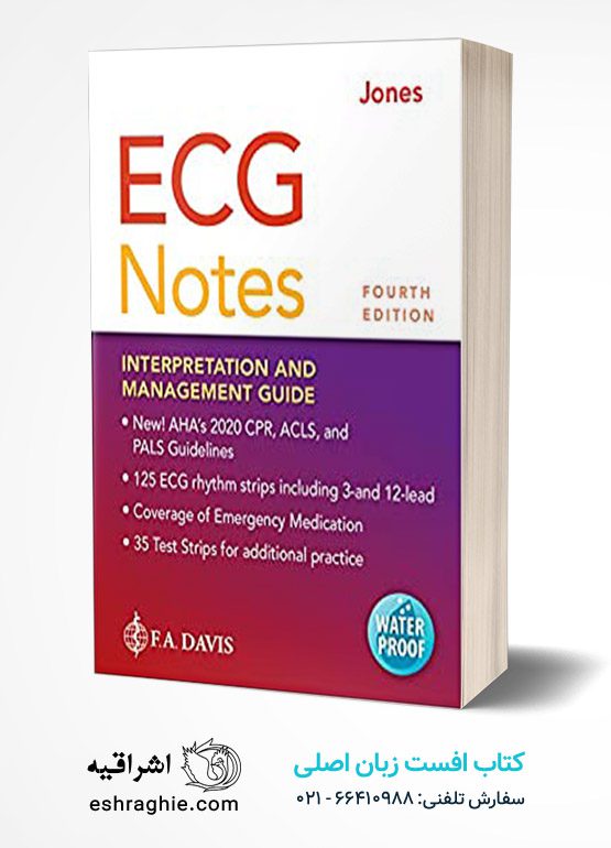 ECG Notes: Interpretation and Management Guide