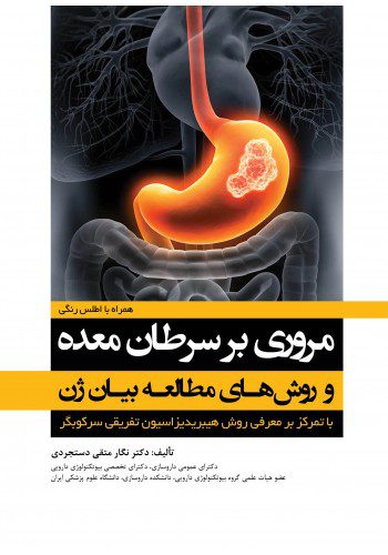 مروری بر سرطان معده و روش های مطالعه بیان ژن
