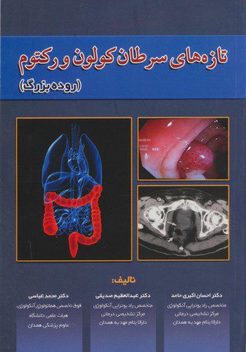 تازه های سرطان کولون و رکتوم (روده بزرگ)