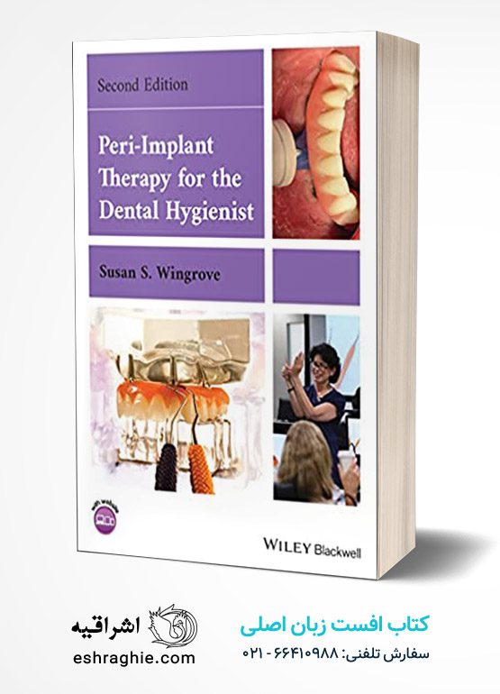 Peri-Implant Therapy for the Dental Hygienist