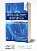 Electrocardiography Of Arrhythmias: A Comprehensive Review