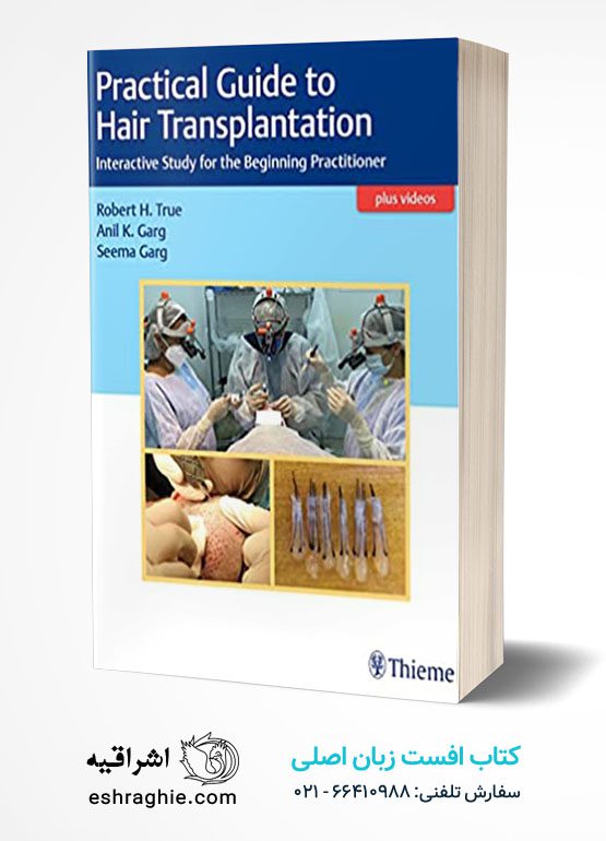 Practical Guide to Hair Transplant