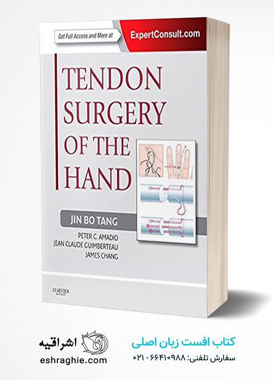 Tendon Surgery of the Hand: Expert Consult - Online and Print