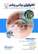 تکنولوژی جراحی چشم
