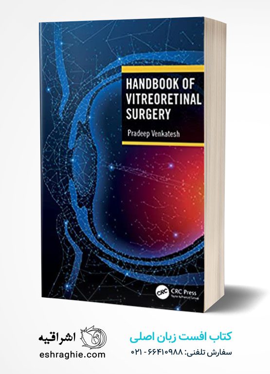Handbook of Vitreoretinal Surgery