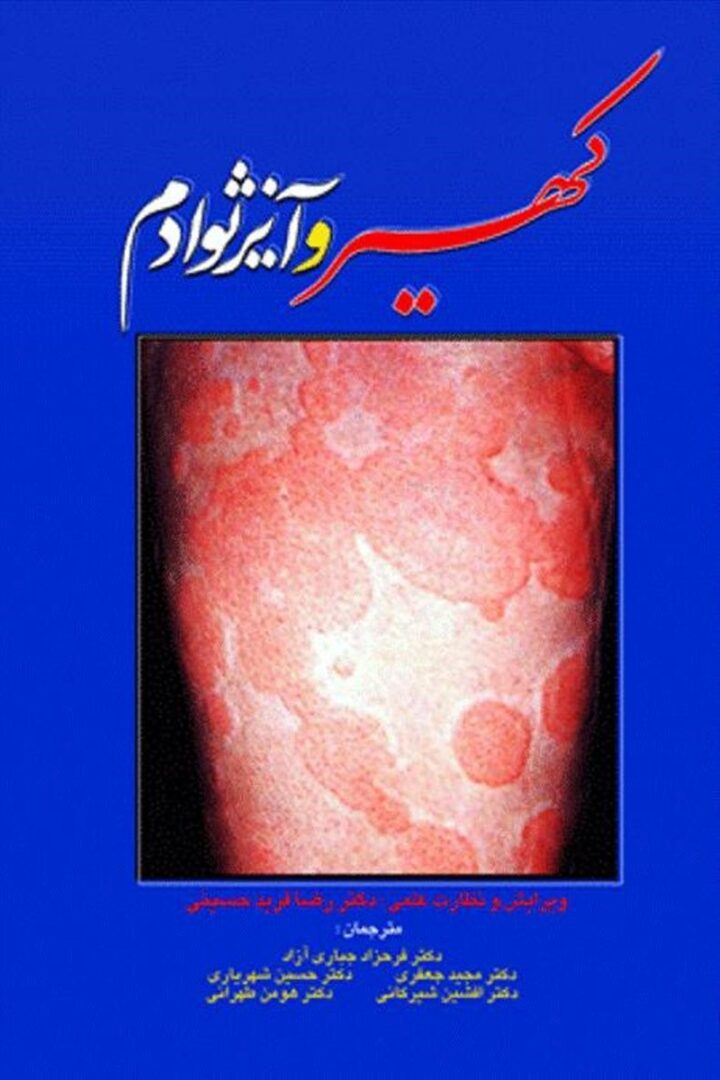 کهیر وآنژیوادم