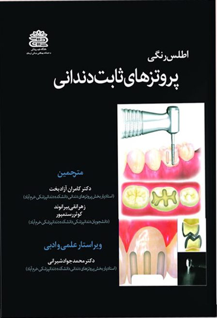 اطلس رنگی پروتز های ثابت دندانی جلد ۱