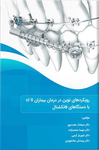 رویکردهای نوین در درمان بیماران cl II با دستگاه های فانکشنال