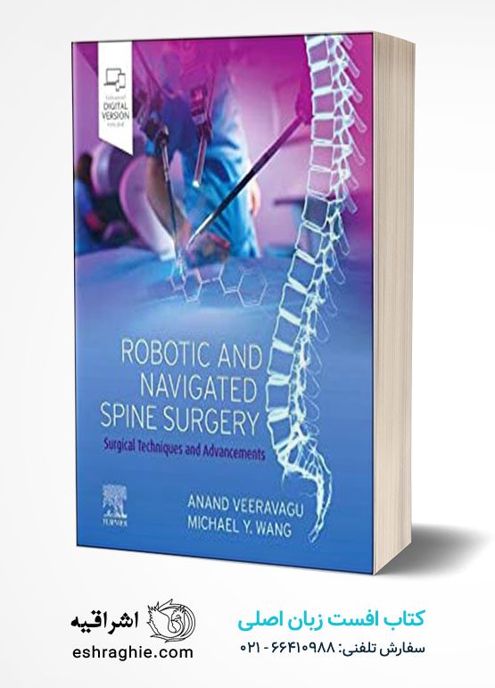 Robotic and Navigated Spine Surgery