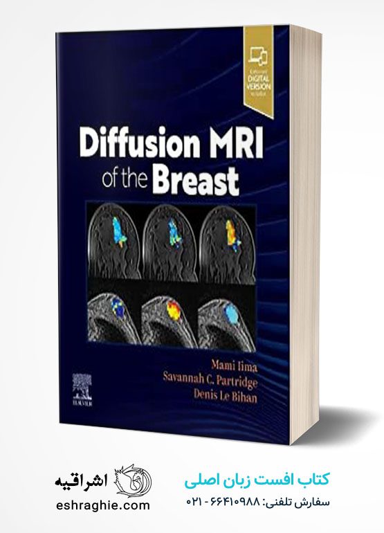 Diffusion MRI of the Breast 1st Edition