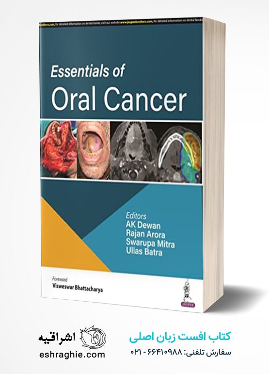 Essentials of Oral Cancer