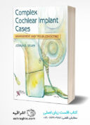 Complex Cochlear Implant Cases: Management And Troubleshooting