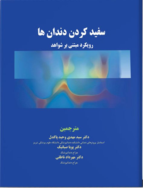 سفید کردن دندان ها – رویکرد مبتنی بر شواهد