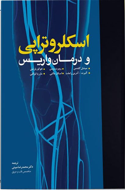 اسکلروتراپی و درمان واریس