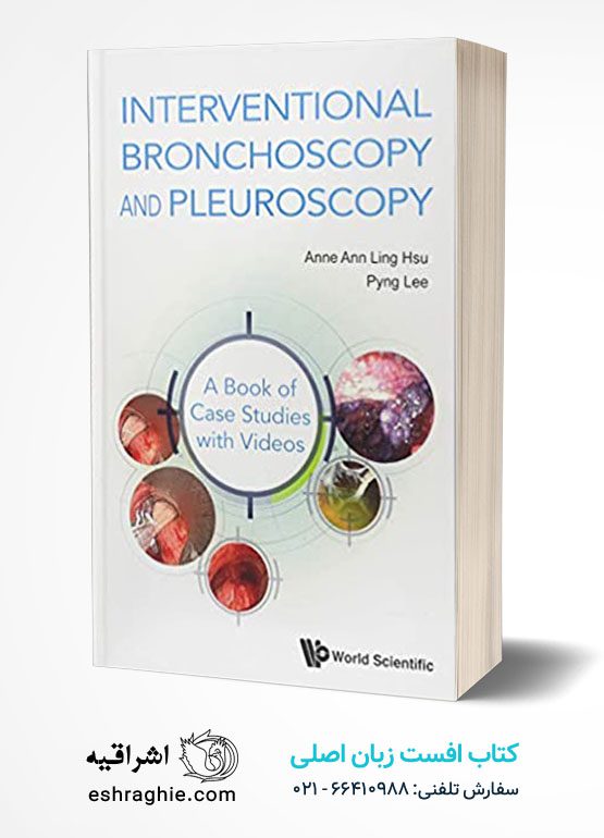 Interventional Bronchoscopy and Pleuroscopy: A Book of Case Studies With Videos 1st Edition