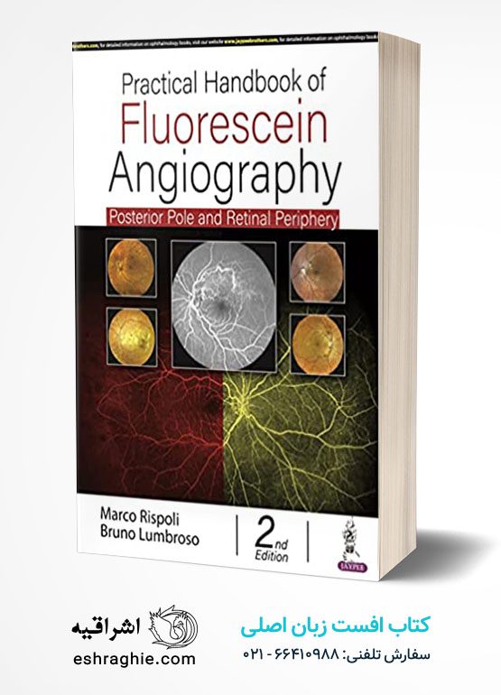 Practical Handbook of Fluorescein Angiography: Posterior Pole and Retinal Periphery 2nd Edition