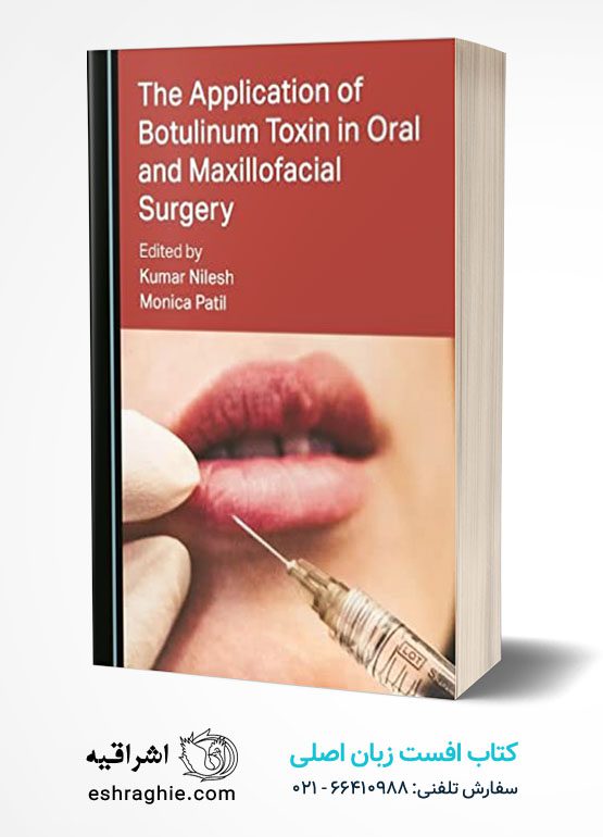 The Application of Botulinum Toxin in Oral and Maxillofacial Surgery