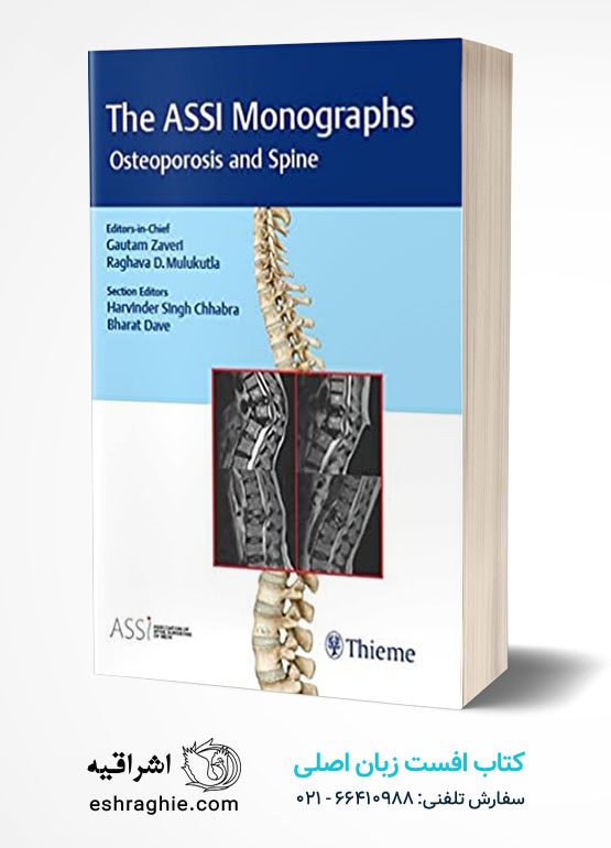 The Assi Monographs Osteoporosis And Spine Hardcover – January 1, 2019