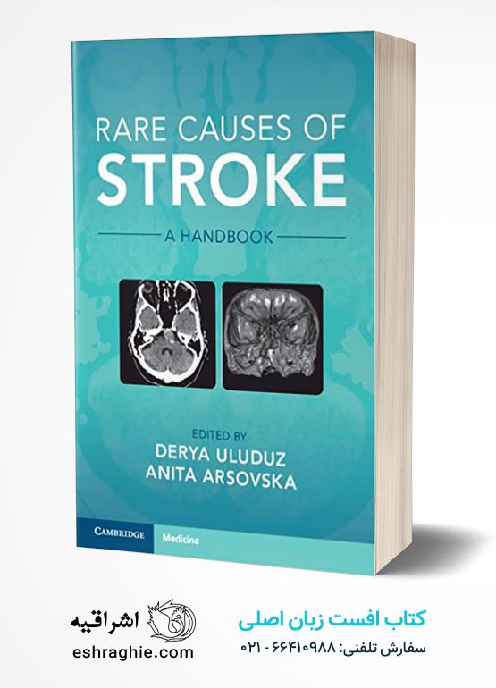Rare Causes of Stroke: A Handbook
