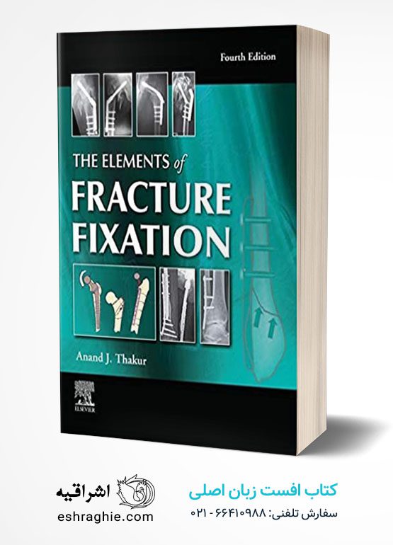 Elements Of Fracture Fixation 4/E