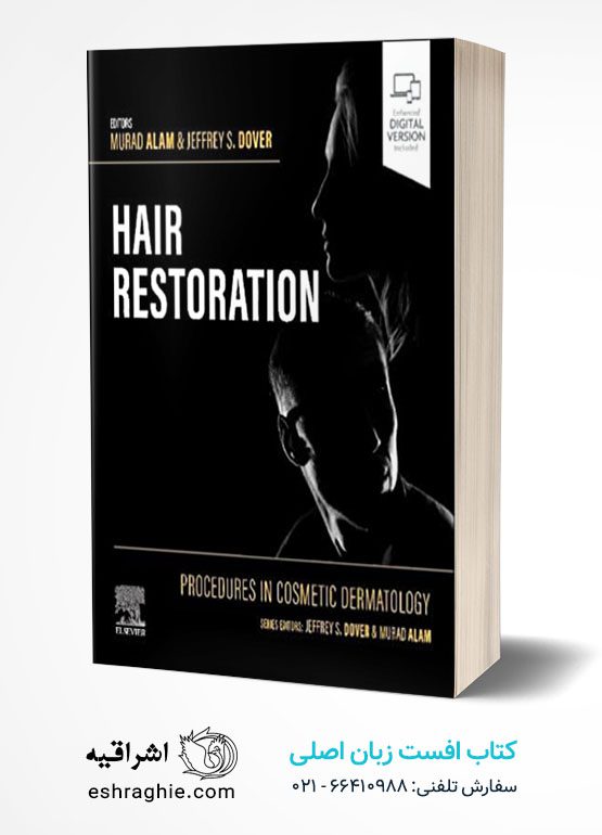Procedures in Cosmetic Dermatology: Hair Restoration