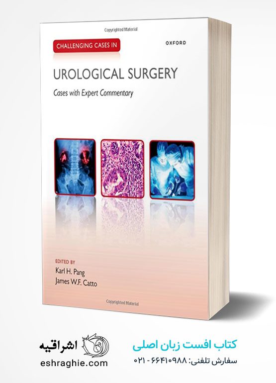 Challenging Cases in Urological Surgery 1st Edition
