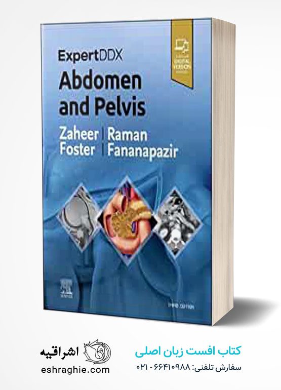 ExpertDDx: Abdomen and Pelvis, 3rd Edition