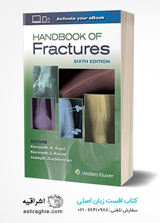 Handbook of Fractures 6th Edition کتاب افست زبان اصلی هندبوک شکستگی های اگول