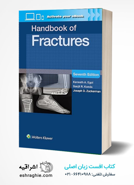 Handbook of Fractures - Egol - 7th Edition کتاب افست زبان اصلی هندبوک شکستگی های اگول - ویرایش هفتم 2025