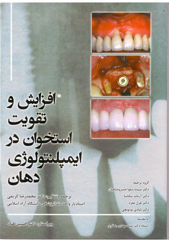 افزایش و تقویت استخوان در ایمپلنتولوژی دهان