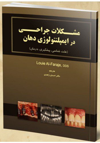 مشکلات جراحی در ایمپلنتولوژی دهان علت شناسی، پیشگیری، درمان