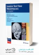 Invasive Skull Base Mucormycosis