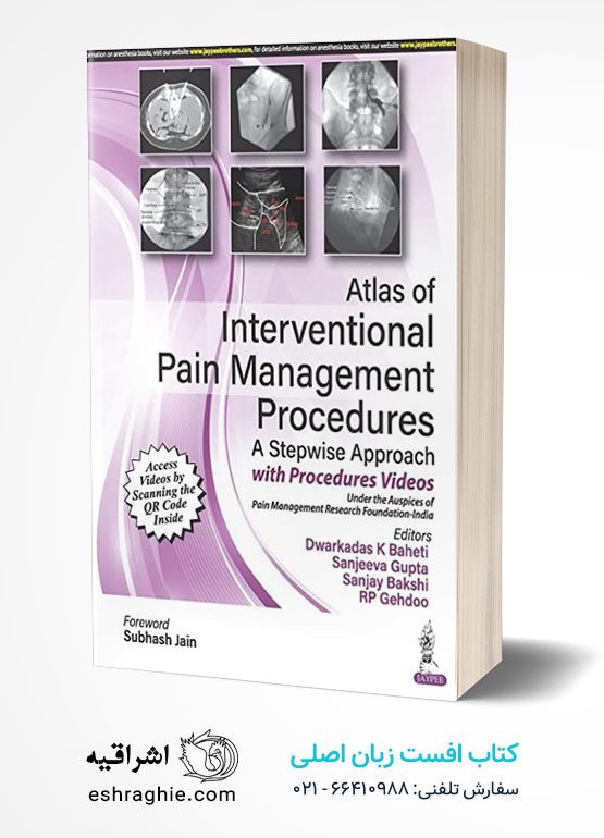 Atlas of Interventional Pain Management Procedures: A Stepwise Approach 1st Edition