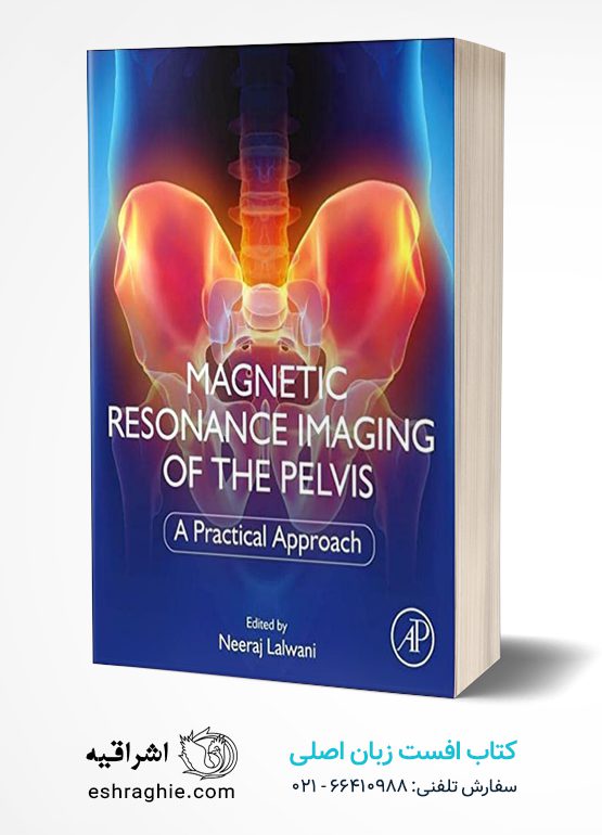 Magnetic Resonance Imaging of The Pelvis: A Practical Approach