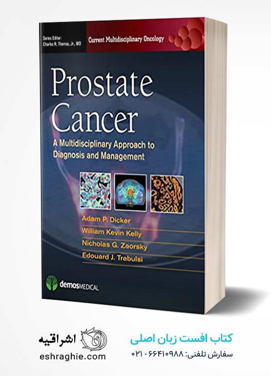Prostate Cancer: A Multidisciplinary Approach to Diagnosis and Management